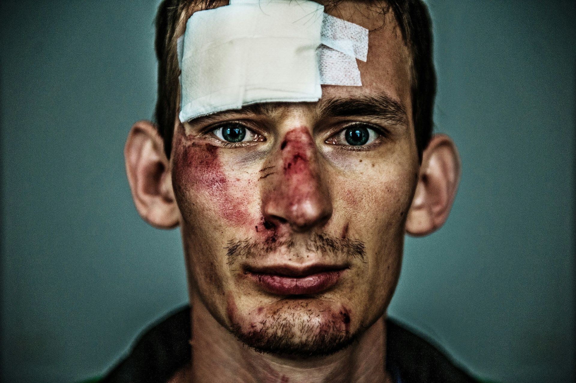 TOS can happen because of Trauma from accidents(Image by Tom Jur/Unsplash)